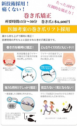 B-foot巻き爪矯正